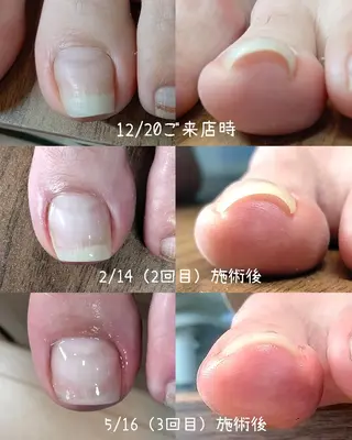 ネイル 【まみ】 Ka Pilinaのネイルデザイン