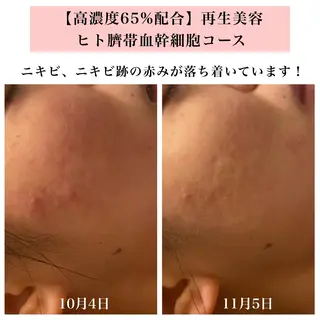Bellesthe (ベルエステ)のエステ・リラクイメージ