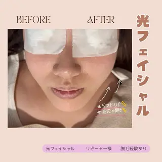 lieupré 脱毛 oshima⌣̈のエステ・リラクイメージ