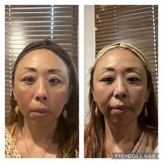Relama/リラマ 美容鍼×マッサージのエステ・リラクイメージ