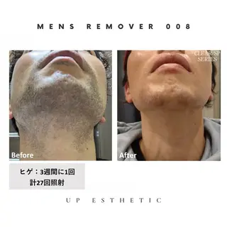 メンズ 韓国肌管理 ウプエステティックのエステ・リラクイメージ