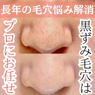 Ella【エラ】 毛穴専門サロンのエステ・リラクイメージ