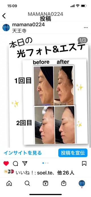 脱毛サロン mamanaのエステ・リラクイメージ