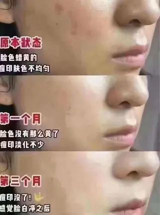 愛維美水光専門店 川崎彩鳳のエステ・リラクイメージ