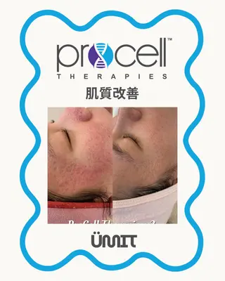 Ümit(ユミト) プロセルセラピーズのヘアスタイル