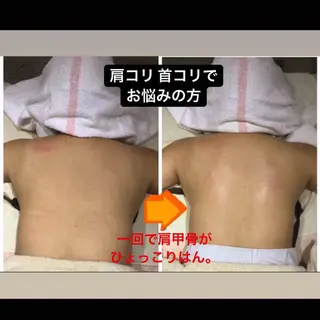 代表 MOMOのエステ・リラクイメージ