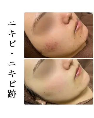 ハーブピーリング専門 BIOPLUS+川崎のエステ・リラクイメージ