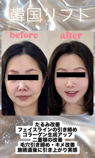 マツエク・マツパ 愛維美水光美肌専門店 メンズレディースokのエステ・リラクイメージ