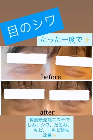 メンズ 美肌脱毛エステサロン Luangeのエステ・リラクイメージ