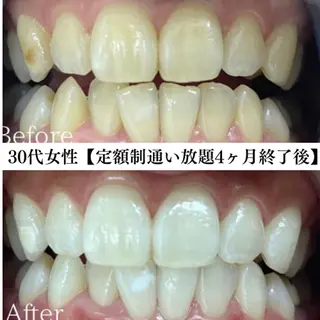 キッズ メンズ セルフホワイトニング WHITE福岡天神店のエステ・リラクイメージ