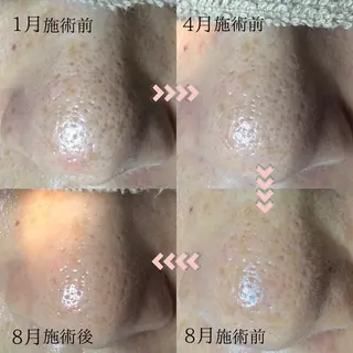 川口 春奈のエステ・リラクイメージ