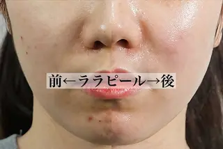 リンパ×ハーブ蒸し TIARA.烏丸三条のエステ・リラクイメージ