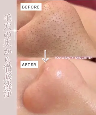 韓国肌管理& ワックス脱毛のエステ・リラクイメージ