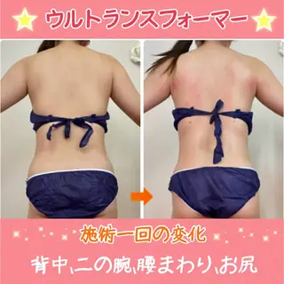ショート カラー パーマ ヘアアレンジ メンズ キッズ ネイル マツエク・マツパ 痩身&ボディ 結果出し🌟丹野のエステ・リラクイメージ