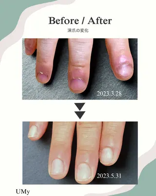 メンズ ネイル 守谷ネイル ◆UMy◆のネイルデザイン