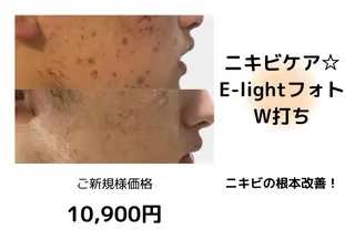 Epina 千葉店 【エピナ】のエステ・リラクイメージ