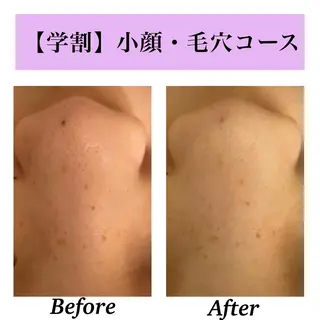 Bellesthe (ベルエステ)のエステ・リラクイメージ