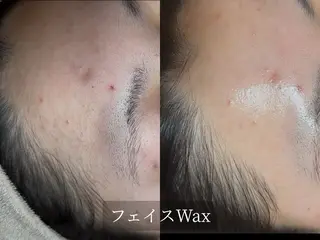脱毛サロン Arumのエステ・リラクイメージ