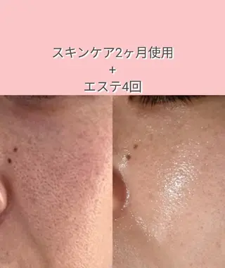 フェイシャルエステ haruのエステ・リラクイメージ