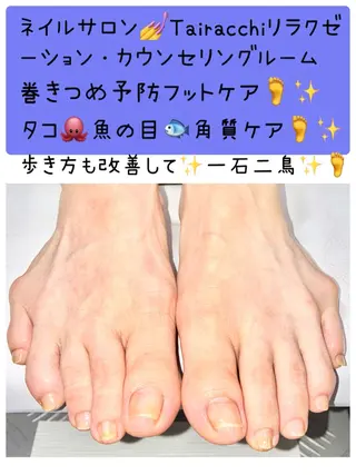 ネイル Tairacchi タイラッチのネイルデザイン