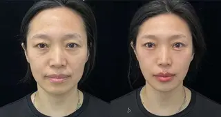 マツエク・マツパ 愛維美水光専門店 川崎彩鳳のエステ・リラクイメージ