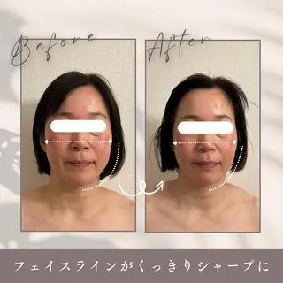 小顔セラピー LILのエステ・リラクイメージ