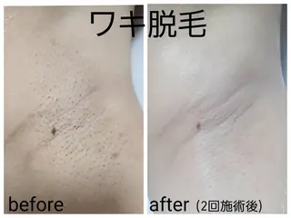 ネイル×アイ×エステ kanunu鶴橋店のマツエク・マツパデザイン