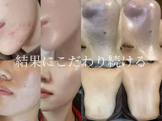 艶肌デトックス🫧 Samiraのエステ・リラクイメージ
