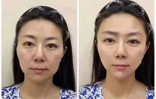 ネイル 愛維美水光専門店 川崎彩鳳のエステ・リラクイメージ