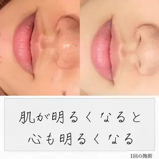 ニキビ経験者が施術 する専門サロン🌻のエステ・リラクイメージ