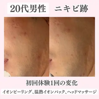 ニキビ・肌質改善専門 ♡人生が変わるサロンのエステ・リラクイメージ