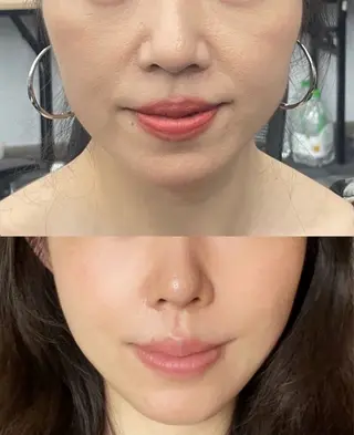 マツエク・マツパ 愛維美水光専門店 川崎彩鳳のエステ・リラクイメージ