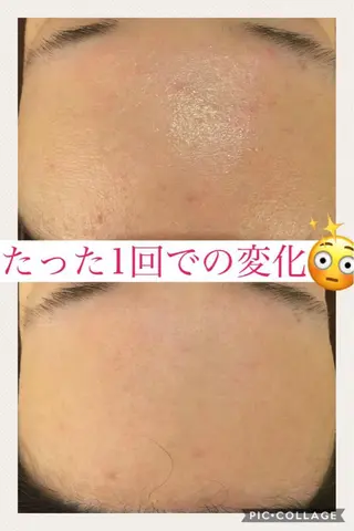 ショート カラー パーマ ヘアアレンジ メンズ キッズ ネイル マツエク・マツパ ニキビ・肌質改善専門 ♡人生が変わるサロンのエステ・リラクイメージ