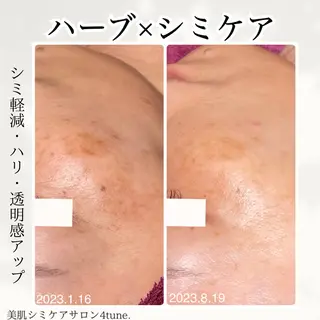 美肌シミケアサロン 4tune.RUMIのその他イメージ