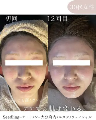 シードリン 府内店 小波のヘアスタイル