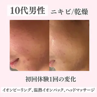 ニキビ・肌質改善専門 ♡人生が変わるサロンのエステ・リラクイメージ