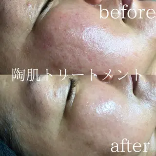 身体の土台作り necorobiのエステ・リラクイメージ