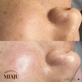 美肌専門サロン MIAJUのエステ・リラクイメージ