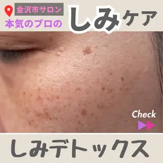 LiZA エステティックサロンのエステ・リラクイメージ