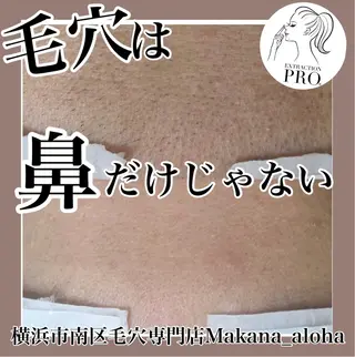 毛穴専門店 マカナアロハのエステ・リラクイメージ