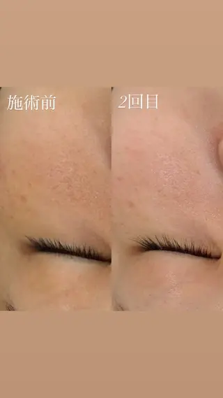 艶肌デトックス🫧 Samiraのエステ・リラクイメージ