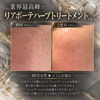 BLOSSOM 菊地のその他イメージ