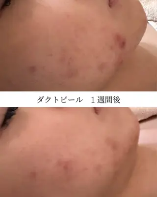 GrandAzure 大人の肌改善のエステ・リラクイメージ