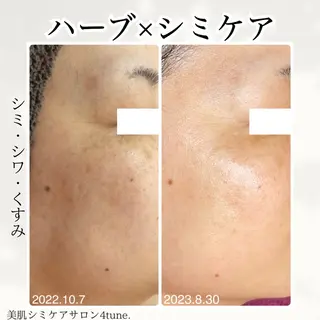 美肌シミケアサロン 4tune.RUMIのその他イメージ