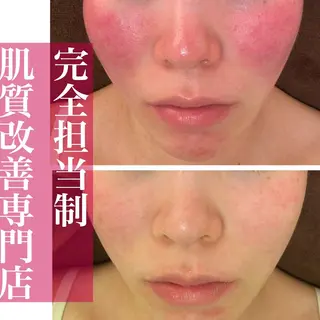 ミディアム カラー パーマ ヘアアレンジ メンズ キッズ ネイル マツエク・マツパ アイブロウ ニキビ・肌質改善専門 ♡人生が変わるサロンのエステ・リラクイメージ