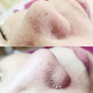 マツエク・マツパ 美肌脱毛&毛穴専門 Anaciaのエステ・リラクイメージ
