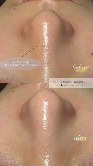トータルボディケア chouchouのその他イメージ