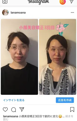 Lana moana spa🌺のエステ・リラクイメージ