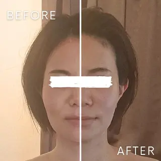 美容鍼×エステ 鍼灸 サロンmiyabiのエステ・リラクイメージ
