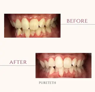 ホワイトニングサロン PURETETHのエステ・リラクイメージ